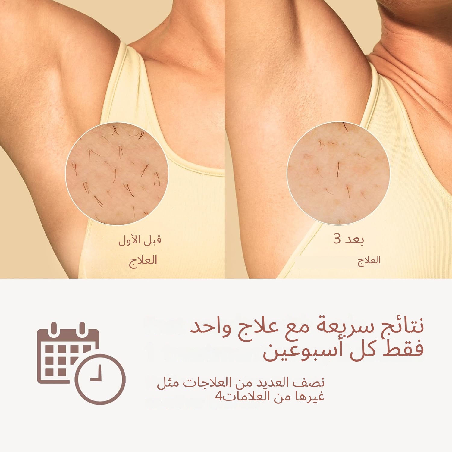 أحدث وصول عام 2026 جهاز إزالة الشعر بالليزر يحقق إزالة الشعر بشكل دائم الكمية محدودة جداً